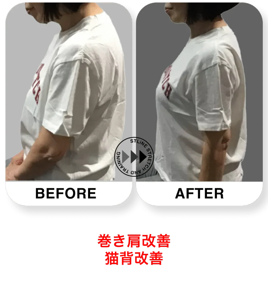 STLiNEグループのお客様のビフォーアフター（効果には個人差があります）